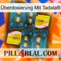 Überdosierung Mit Tadalafil cialis5
